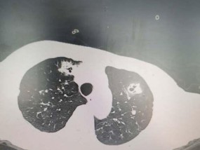 手机拍照出现斑影是什么原因？