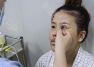 如何粘双眼皮纸带眼镜视频？步骤和技巧是什么？