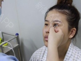 如何粘双眼皮纸带眼镜视频？步骤和技巧是什么？