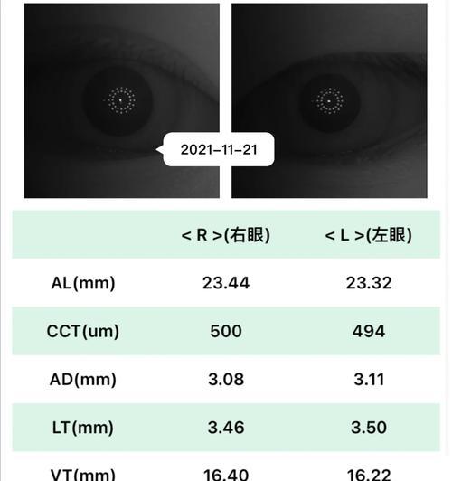 验光投影仪的调试步骤是什么？  第2张