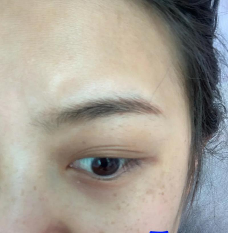 手机拍照出现斑影是什么原因？  第2张