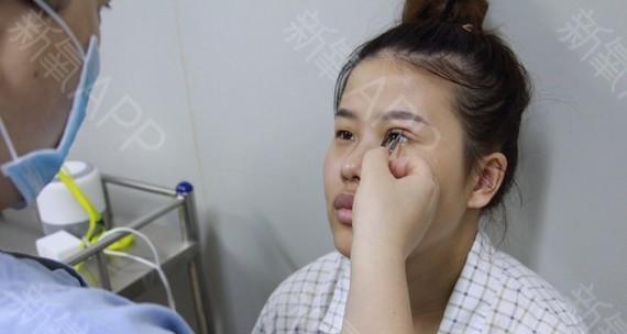 如何粘双眼皮纸带眼镜视频？步骤和技巧是什么？  第1张
